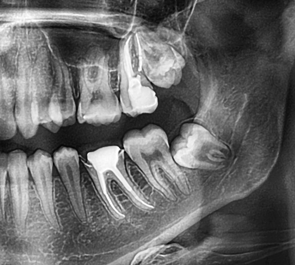 cirurgia oral