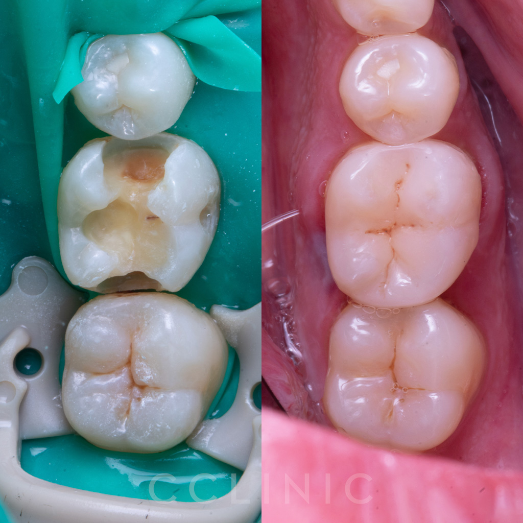 Dentisteria - Caso 4