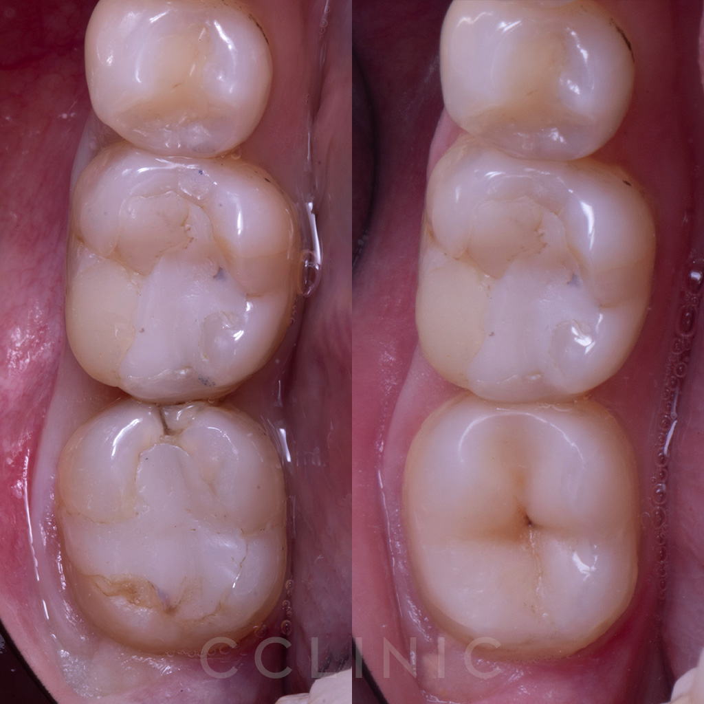 Dentisteria - Caso 5